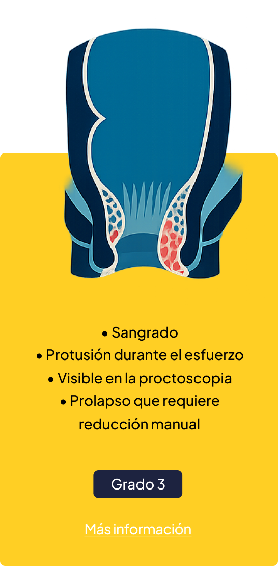 Frente
