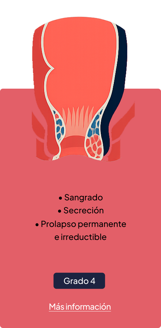 Frente