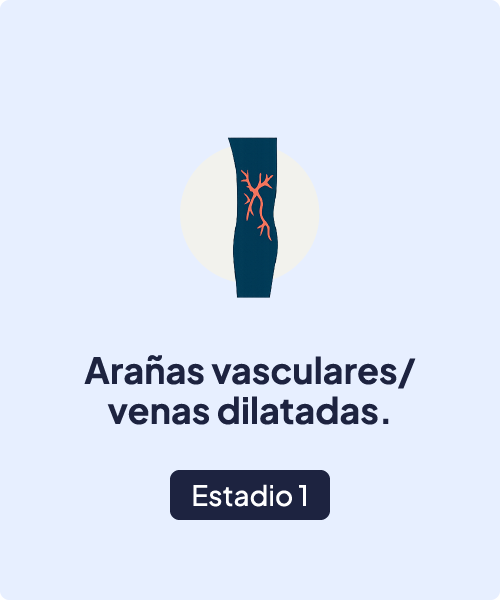 Estadio 1