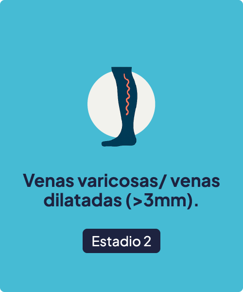 Estadio 2