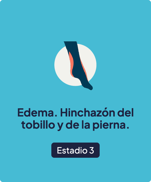 Estadio 3