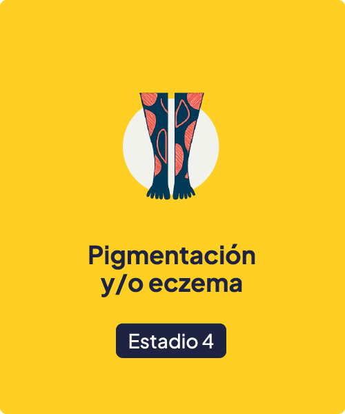 Estadio 4