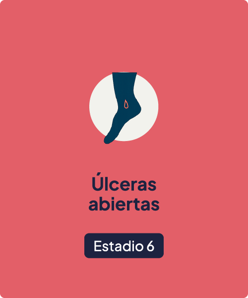 Estadio 6